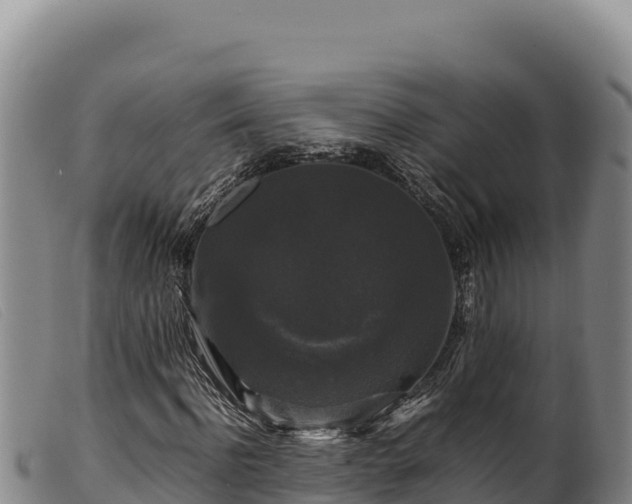 X0000099550916200805231147