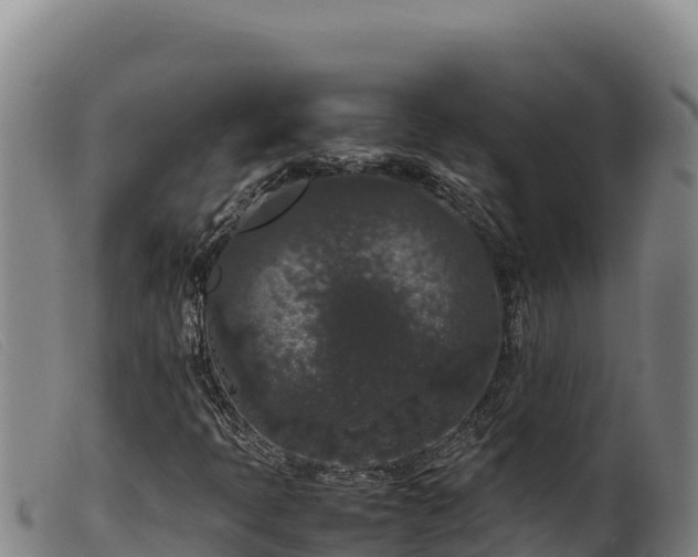 X0000099551397200805231140