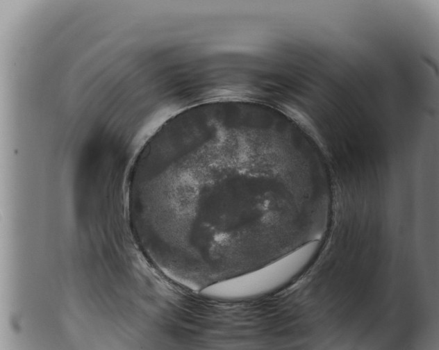 X0000099551419200805231140