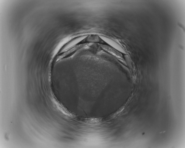 X0000099550056200805301529