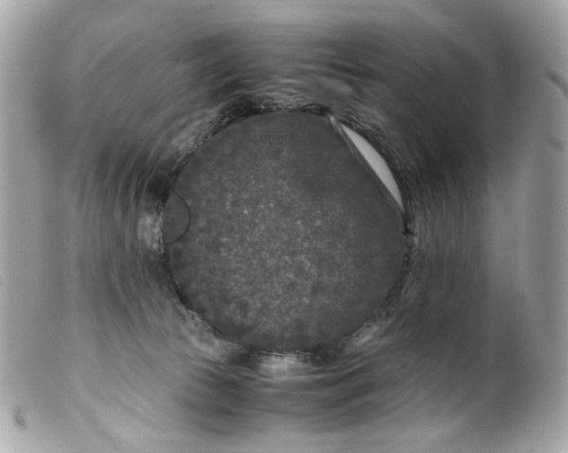 X0000099550177200805301528