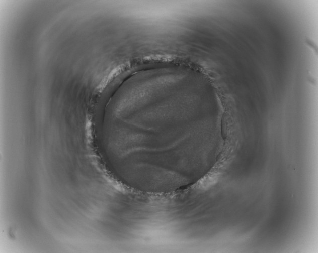 X0000099550192200805301528