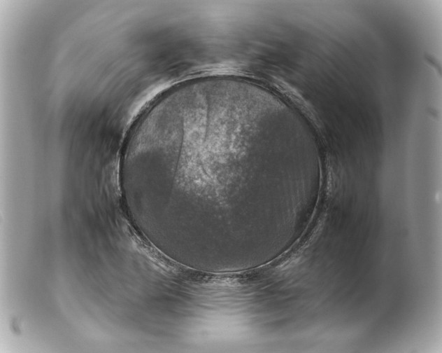 X0000099551174200805301515