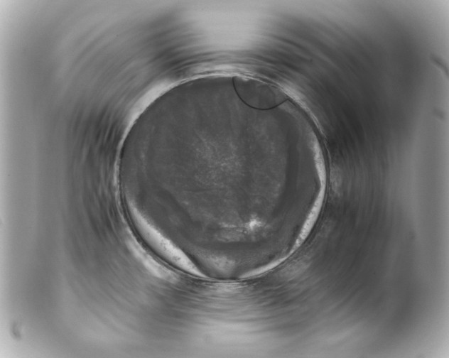 X0000099551482200805301511