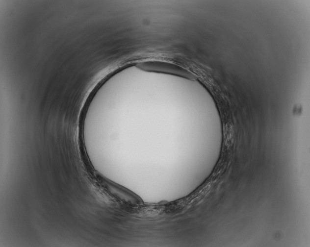 X0000099550148200806061525