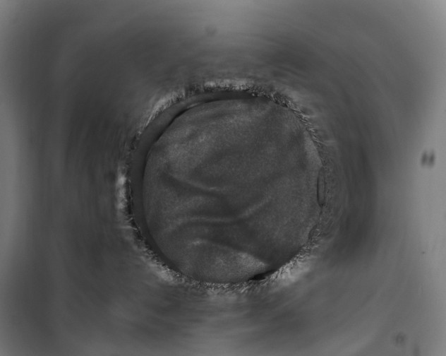 X0000099550192200806061525