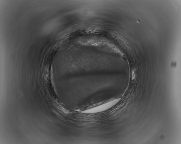 X0000099551011200806061511