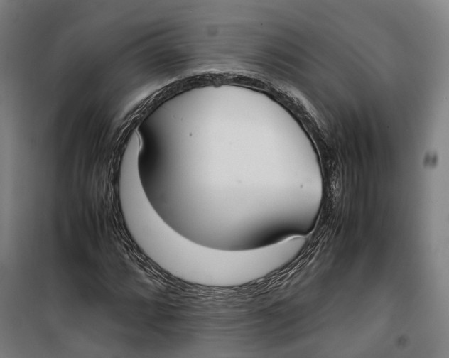 X0000099551064200806061511