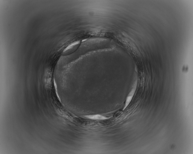 X0000099551154200806061510