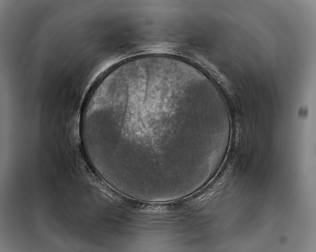 X0000099551174200806061510