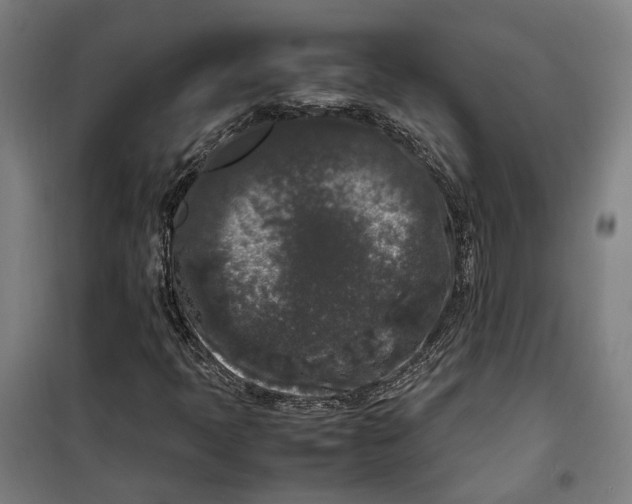 X0000099551397200806061506