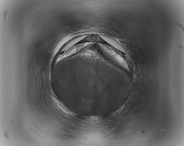 X0000099550056200806131221