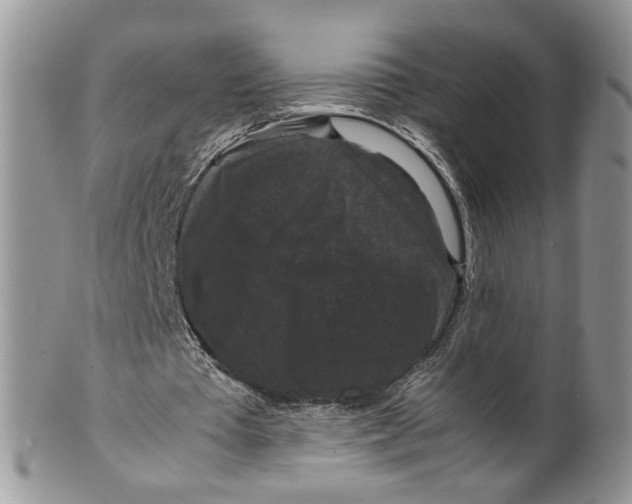 X0000099550385200806131217