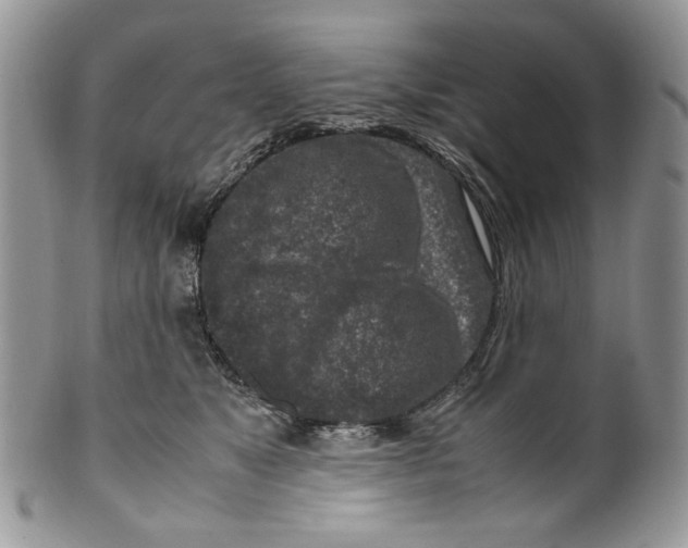 X0000099550517200806131215