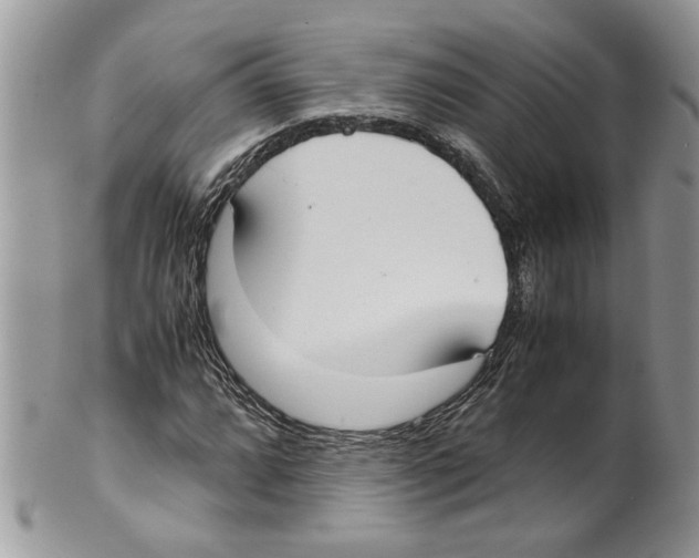 X0000099551064200806131207