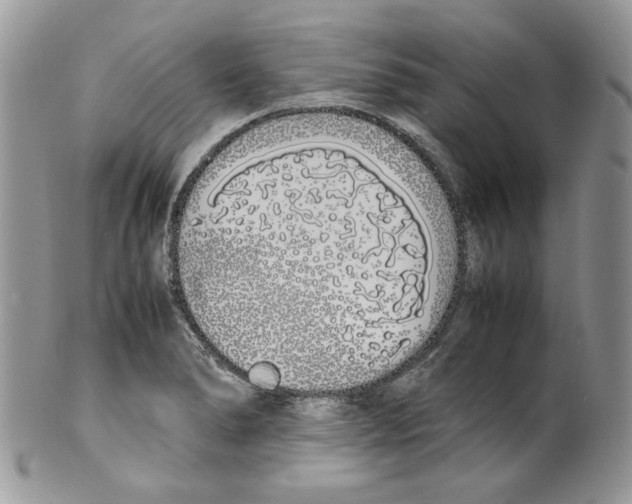 X0000099551278200806131204