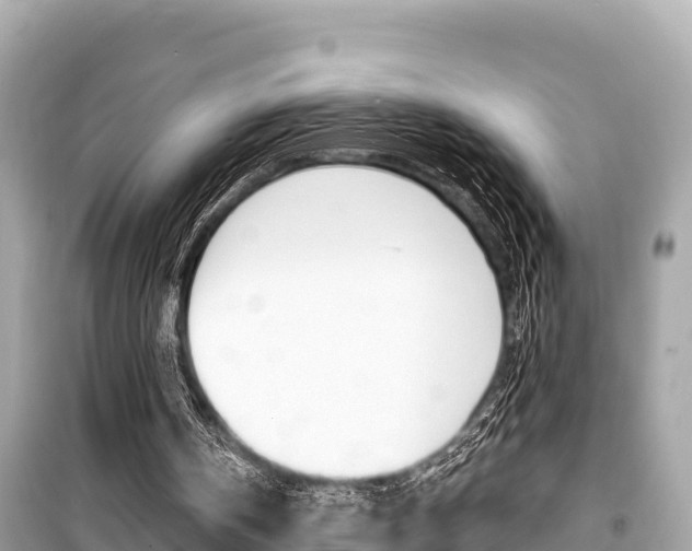 X0000099560146200805160759