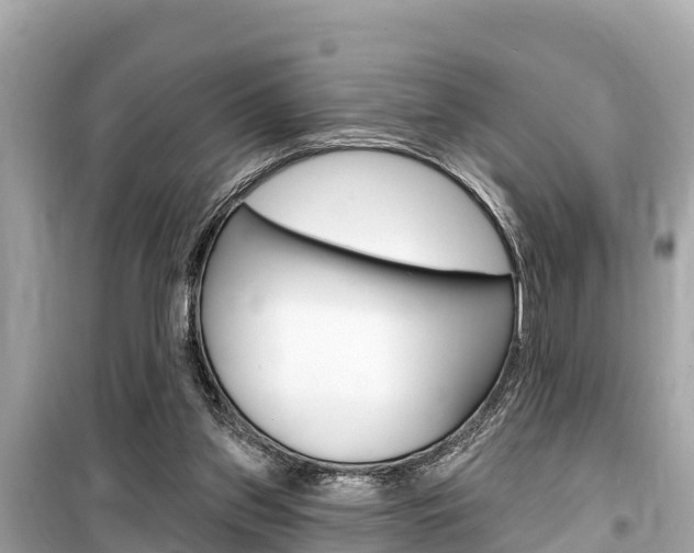 X0000099560157200805160759