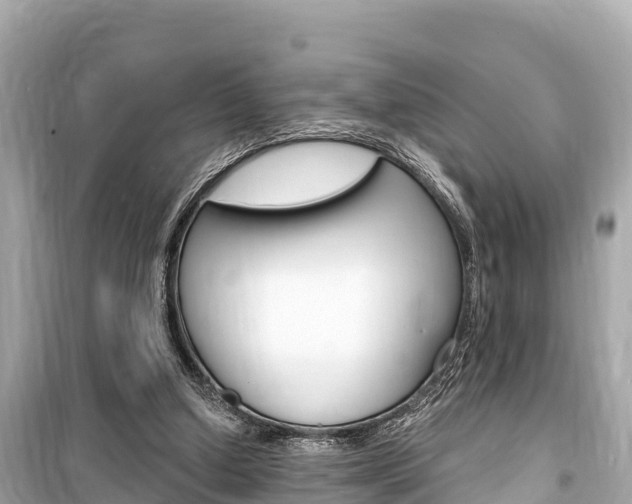 X0000099560250200805160757