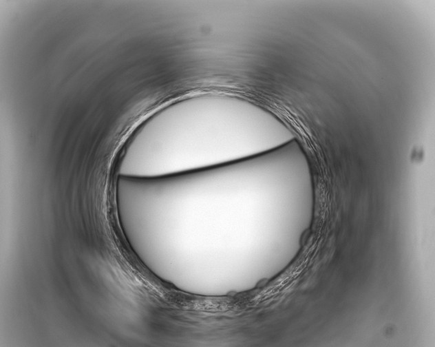 X0000099560338200805160755