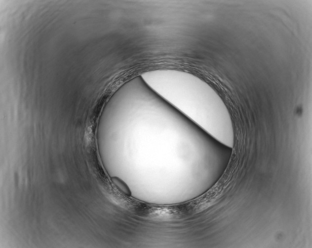 X0000099560611200805160752