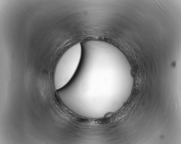 X0000099560656200805160751