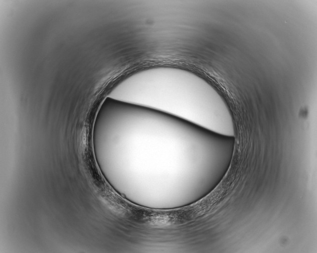 X0000099560740200805160750
