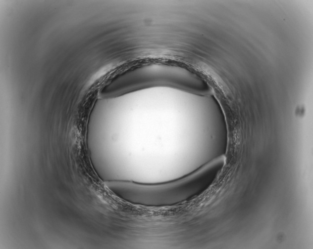 X0000099561064200805160745