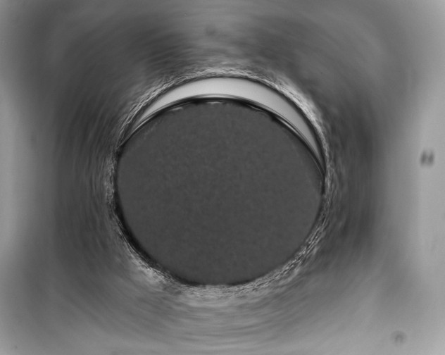 X0000099560009200805161504