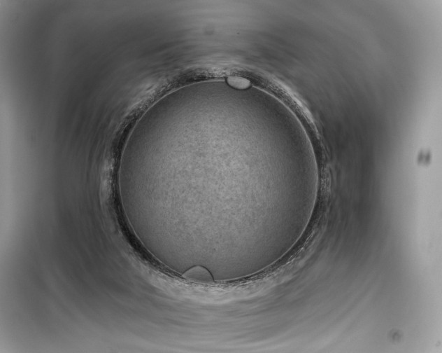 X0000099560018200805161504