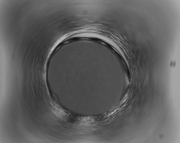 X0000099560100200805161502