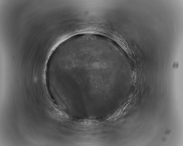 X0000099560292200805161459