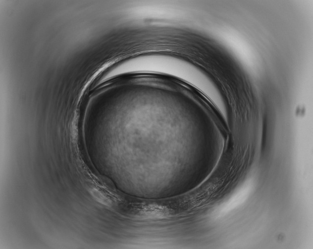 X0000099560387200805161458