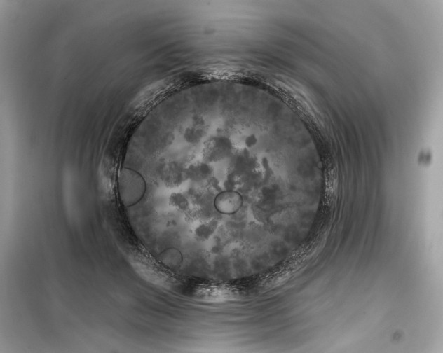 X0000099560503200805161456