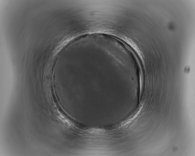 X0000099560577200805161455