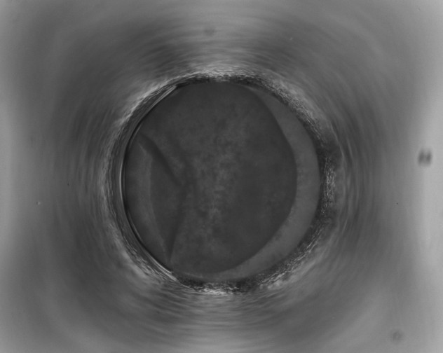 X0000099560592200805161455