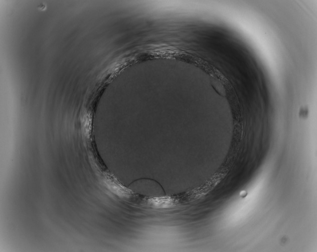 X0000099560767200805161452