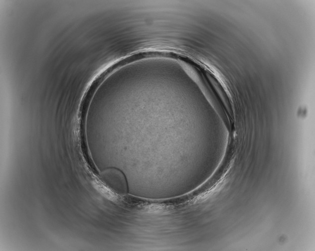 X0000099560779200805161451