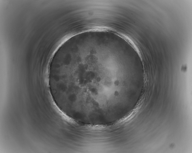 X0000099560851200805161451