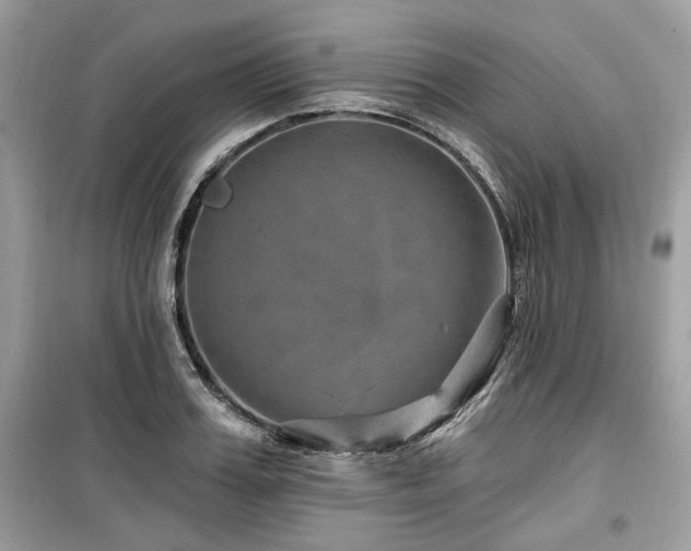 X0000099560987200805161448