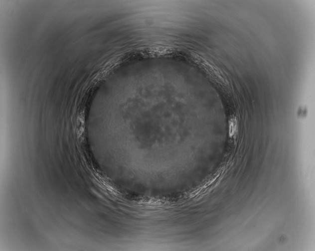 X0000099561011200805161447