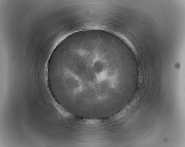 X0000099561031200805161447