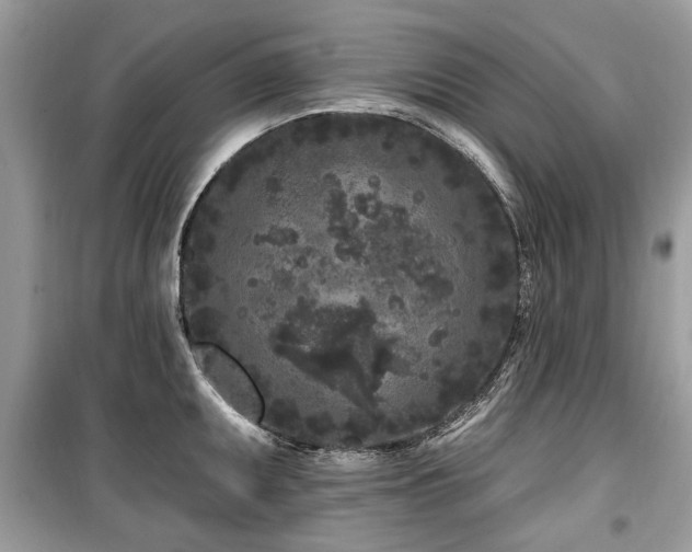 X0000099561095200805161446