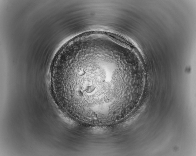 X0000099561125200805161445