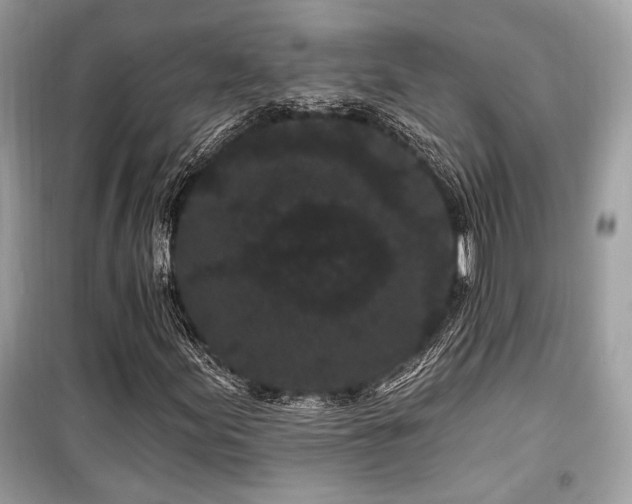 X0000099561155200805161445