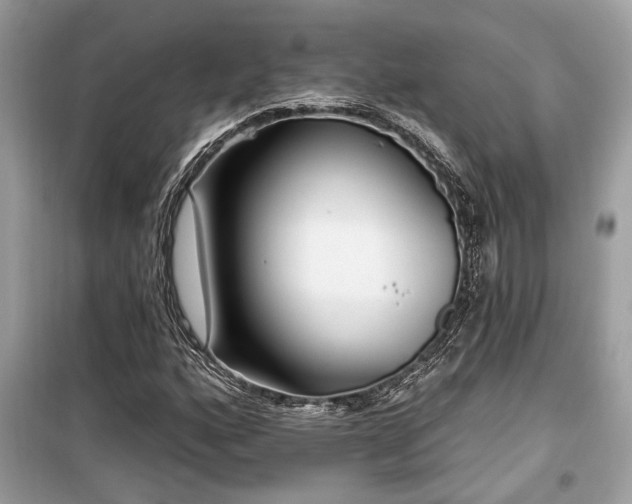 X0000099561160200805161445