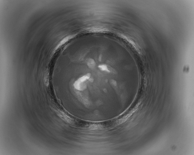 X0000099561306200805161442