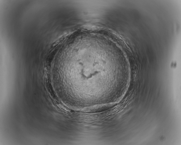 X0000099561397200805161440