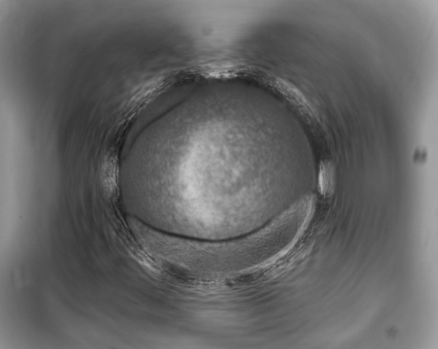 X0000099561444200805161440