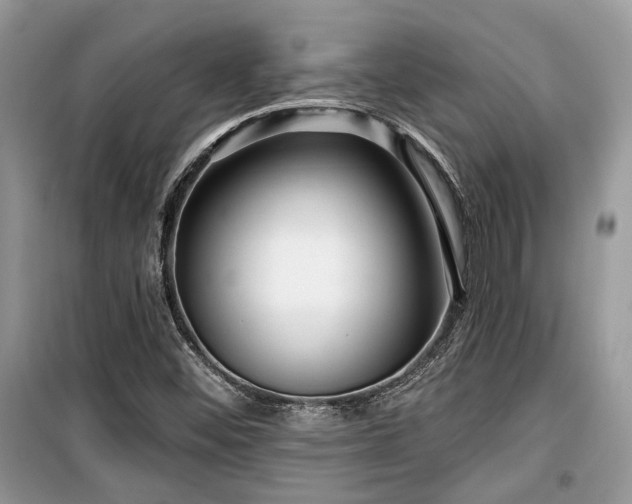 X0000099561452200805161440